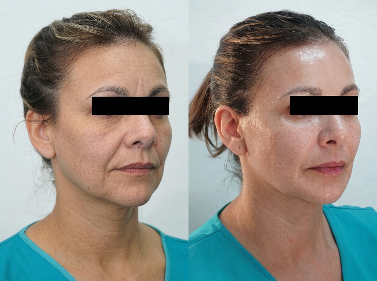 Medicina Cosmética y Armonización Facial
