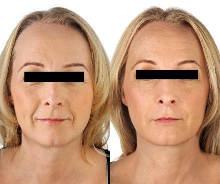 Medicina Cosmética y Armonización Facial