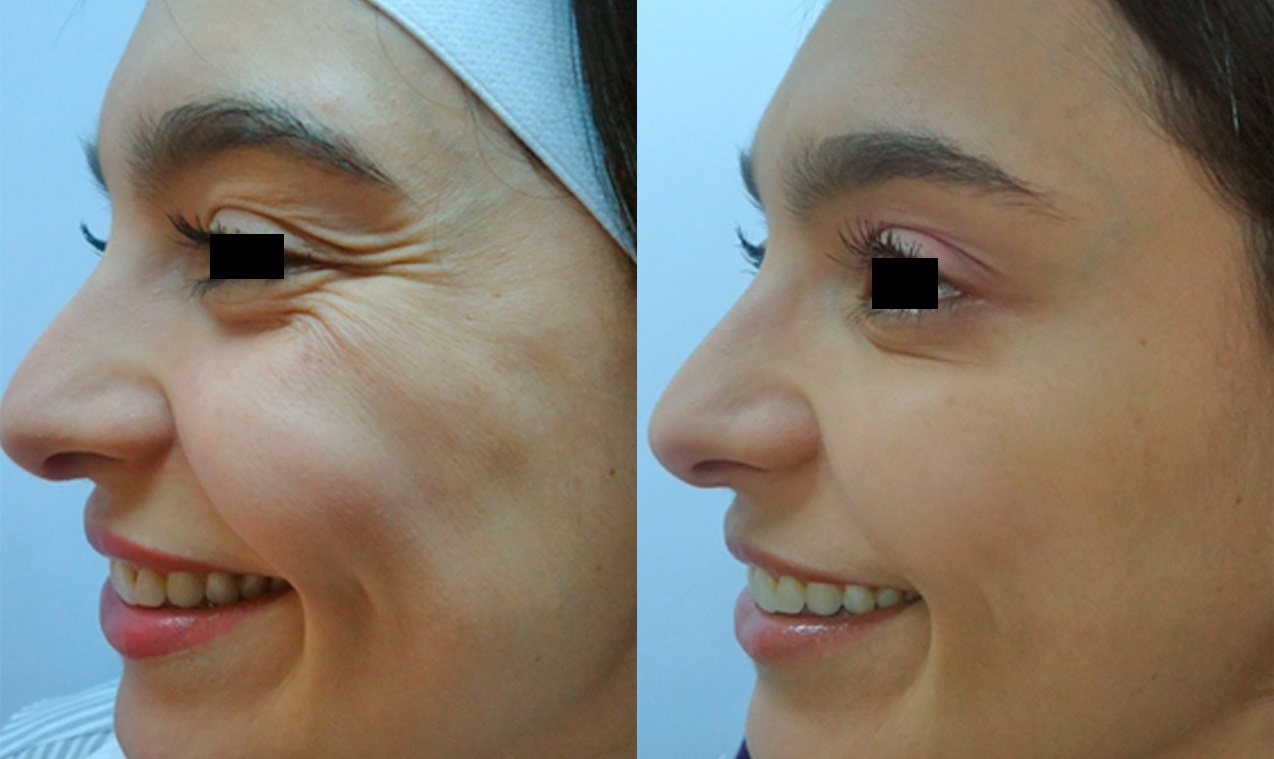 Medicina Cosmética y Armonización Facial