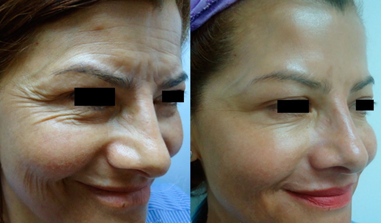 Medicina Cosmética y Armonización Facial
