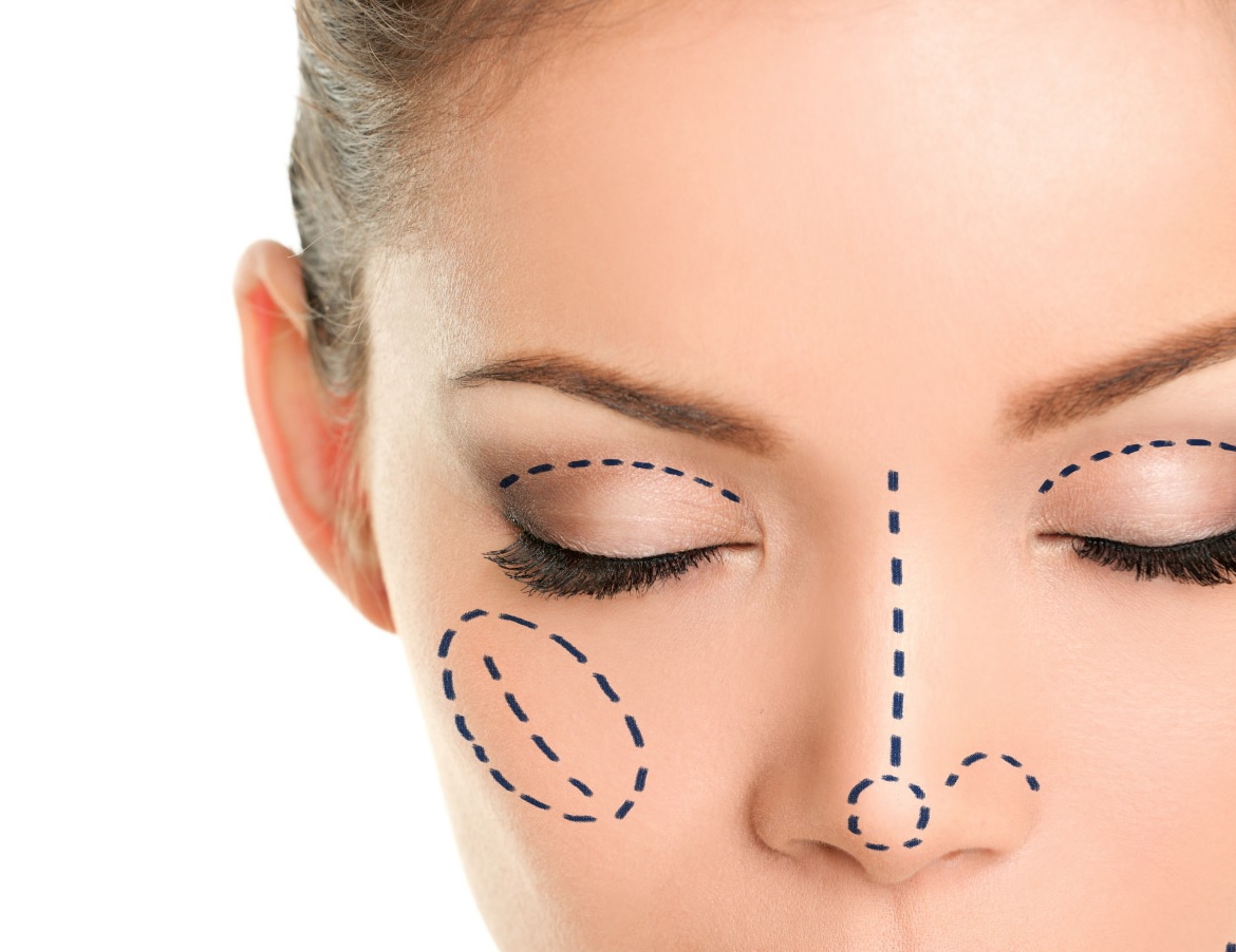 Tratamiento del Síndrome de Parry Romberg (Hemiatrofia Facial)